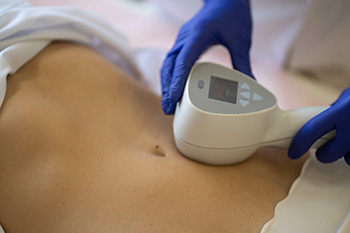 Процедура RF-лифтинг Exilis Elite